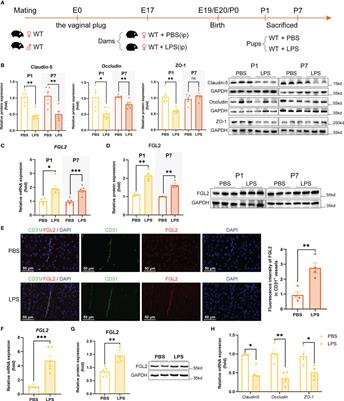FGL2 deficiency alleviates maternal inflammation-induced blood-brain barrier damage by blocking PI3K/NF-κB mediated endothelial oxidative stress